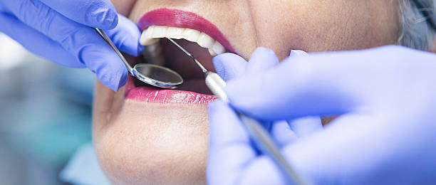 Best Emergency Dental Care for Broken or Chipped Teeth in Manchester, KY